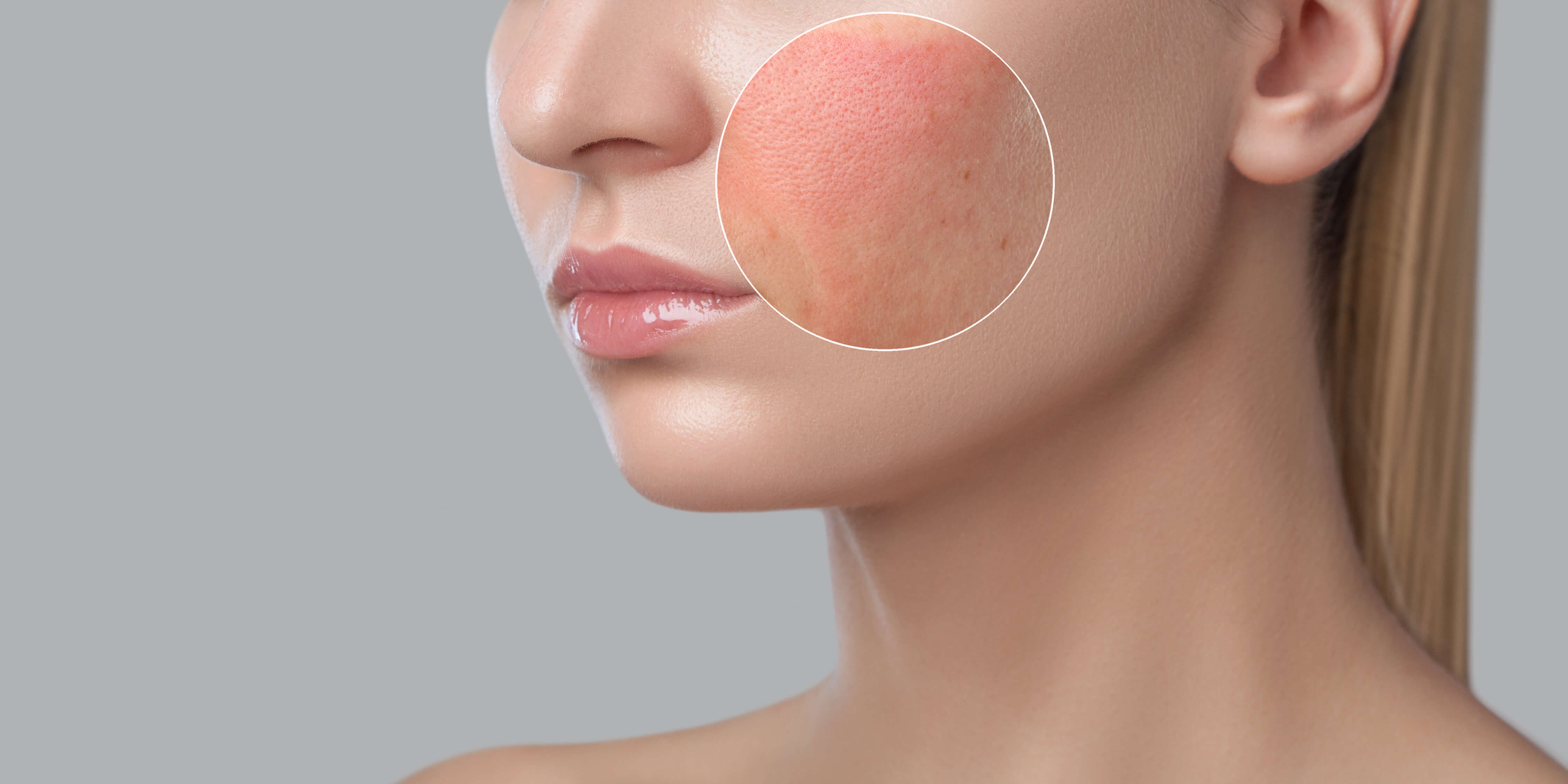 Facial Rash 6 Common Causes Symptoms And When To Seek Treatment Dr 